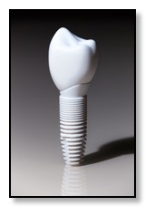 all ceramic dental implant white