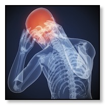 medical image example of headaches from tmj pain