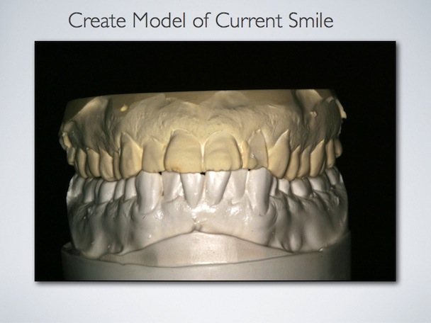 Smile design process image 4