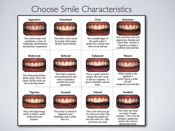 Smile design process image 3