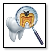 Tooth with cavity and fracture needs a dental crown