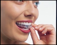 woman putting in invisalign aligner step 2