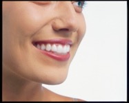 woman putting in invisalign aligner step 3